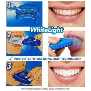 White Light Teeth Brightener