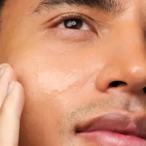 The Ordinary Niacinamide 10% + Zinc 1% , 30ml | Best Quality Niacinamide Serum | Serum For Skin - Niacinamide Serum